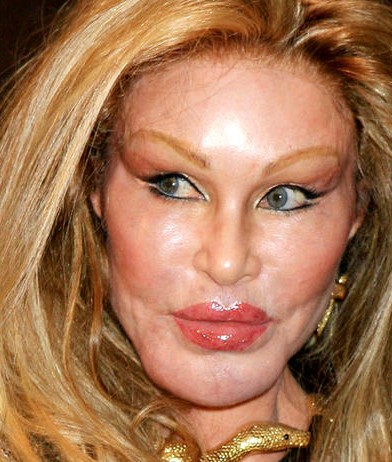 Jocelyn-Wildenstein-plastic-surgery-gone-wrong-too-much-392x462